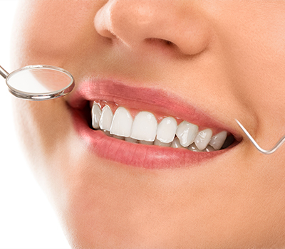 Digital Smile Design